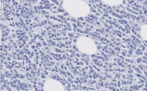 Anti-phosphotyrosine Antibody, clone 4G10 ZooMAb Mouse Monoclonal 