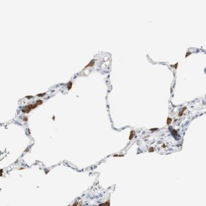 Anti-PI15 antibody produced in rabbit HPA006593-100UL