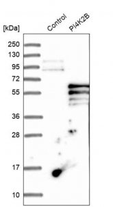 Anti-PI4K2B antibody produced in rabbit HPA004099-100UL