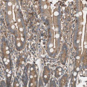 Anti-PI4K2B antibody produced in rabbit HPA004099-100UL
