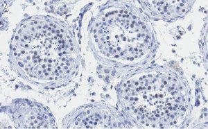 Anti-PIAS Antibody, clone 1O17 ZooMAb Rabbit Monoclonal 