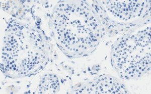 Anti-PIAS Antibody, clone 1O17 ZooMAb Rabbit Monoclonal 