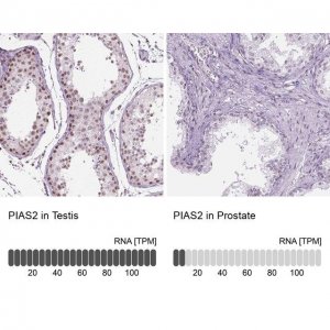 Anti-PIAS2 antibody produced in rabbit 