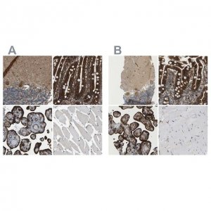 Anti-PICALM antibody produced in rabbit 