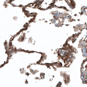 Anti-PIEZO1 antibody produced in rabbit 