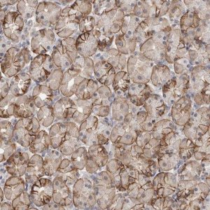 Anti-PIGP antibody produced in rabbit 