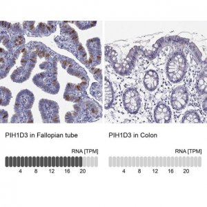 Anti-PIH1D3 