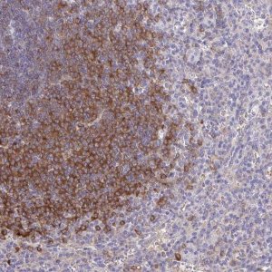 Anti-PIK3AP1 antibody produced in rabbit 