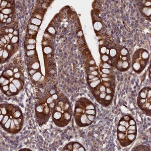 Anti-PIK3C3 antibody produced in rabbit 