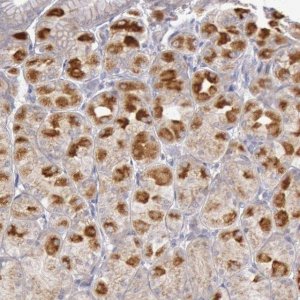 Anti-PIK3R1 antibody produced in rabbit 