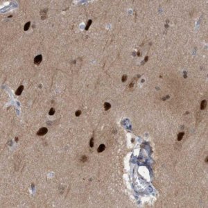 Anti-PINX1 antibody produced in rabbit HPA023139-100UL