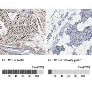 Anti-PITRM1 antibody produced in rabbit HPA006753-100UL