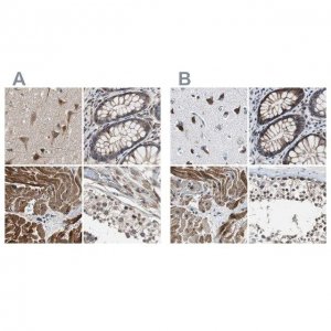 Anti-PITRM1 antibody produced in rabbit HPA006753-100UL