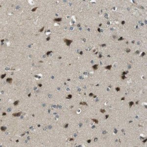 Anti-PJA1 antibody produced in rabbit 