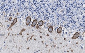Anti-PKC Antibody, clone 1C13 ZooMAb Rabbit Monoclonal 