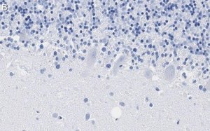 Anti-PKC Antibody, clone 1C13 ZooMAb Rabbit Monoclonal 