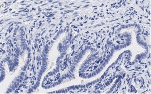 Anti-PKC Antibody, clone 1J13 ZooMAb Rabbit Monoclonal 