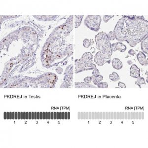 Anti-PKDREJ antibody produced in rabbit 