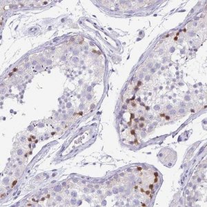 Anti-PKDREJ antibody produced in rabbit 