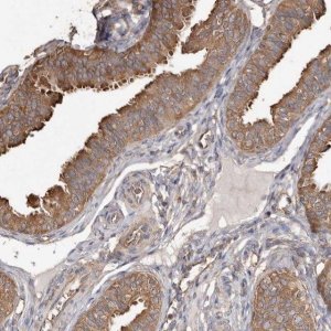 Anti-PKM antibody produced in rabbit HPA029501-100UL