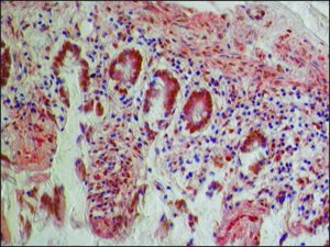 Anti-PKM2 (isoform M1) antibody produced in rabbit 