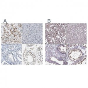 Anti-PKP2 antibody produced in rabbit 