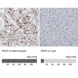 Anti-PKP2 antibody produced in rabbit 