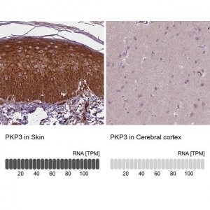 Anti-PKP3 antibody produced in rabbit 