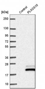 Anti-PLA2G10 antibody produced in rabbit 