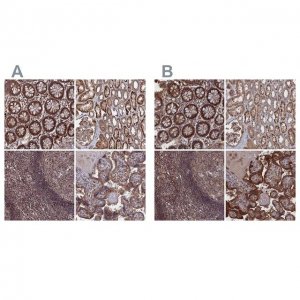 Anti-PLA2G15 antibody produced in rabbit 