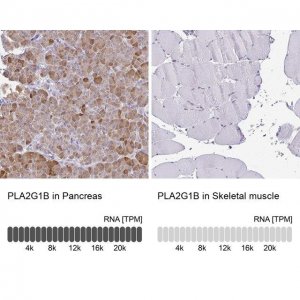 Anti-PLA2G1B antibody produced in rabbit 