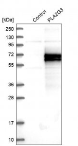 Anti-PLA2G3 antibody produced in rabbit 