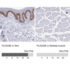 Anti-PLA2G4E antibody produced in rabbit 