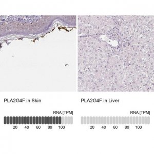 Anti-PLA2G4F antibody produced in rabbit 