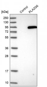 Anti-PLA2G6 antibody produced in rabbit 