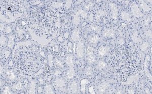 Anti-PLA2R1 Antibody, clone 1D5, ZooMAb Rabbit Monoclonal 