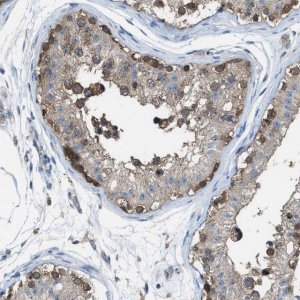 Anti-PLAA antibody produced in rabbit 