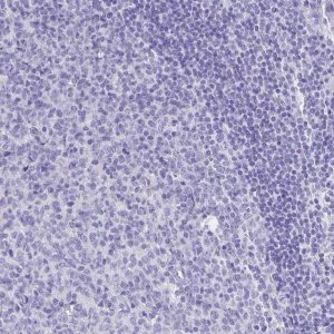 Anti-PLAC1 antibody produced in rabbit 