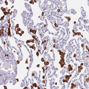 Anti-PLBD1 antibody produced in rabbit 