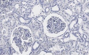 Anti-PLD2 Antibody, clone 6F13 ZooMAb Rabbit Monoclonal 