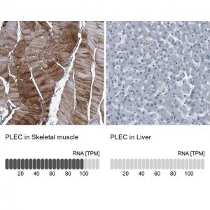 Anti-PLEC antibody produced in rabbit 