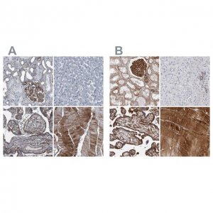 Anti-PLEC antibody produced in rabbit 