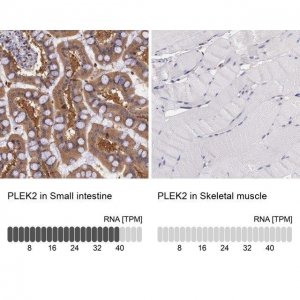 Anti-PLEK2 antibody produced in rabbit 