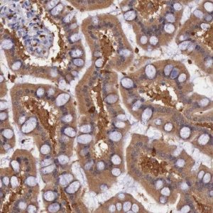 Anti-PLEK2 antibody produced in rabbit 