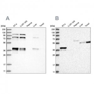 Anti-PLEKHA3 antibody produced in rabbit 
