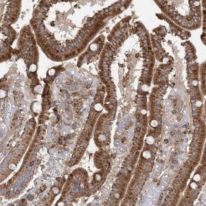 Anti-PLEKHA7 antibody produced in rabbit 