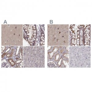 Anti-PLEKHG3 antibody produced in rabbit 