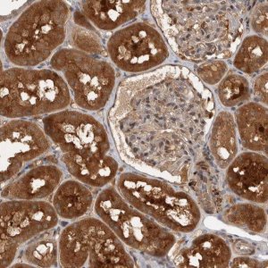 Anti-PLEKHM1 antibody produced in rabbit 