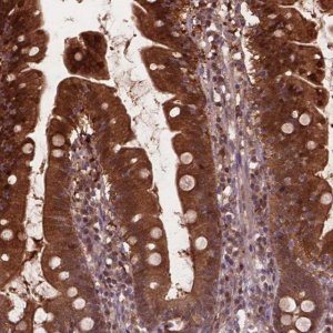 Anti-PLIN3 antibody produced in rabbit 