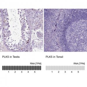 Anti-PLK5 antibody produced in rabbit 